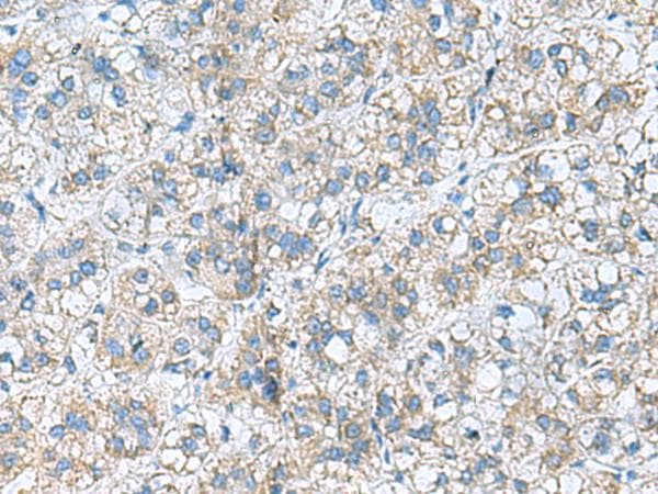RPL10A Antibody