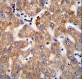 SOWAHD / ANKRD58 Antibody (aa196-224)