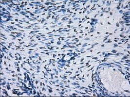 PSMA7 Antibody (clone OTI8F9)