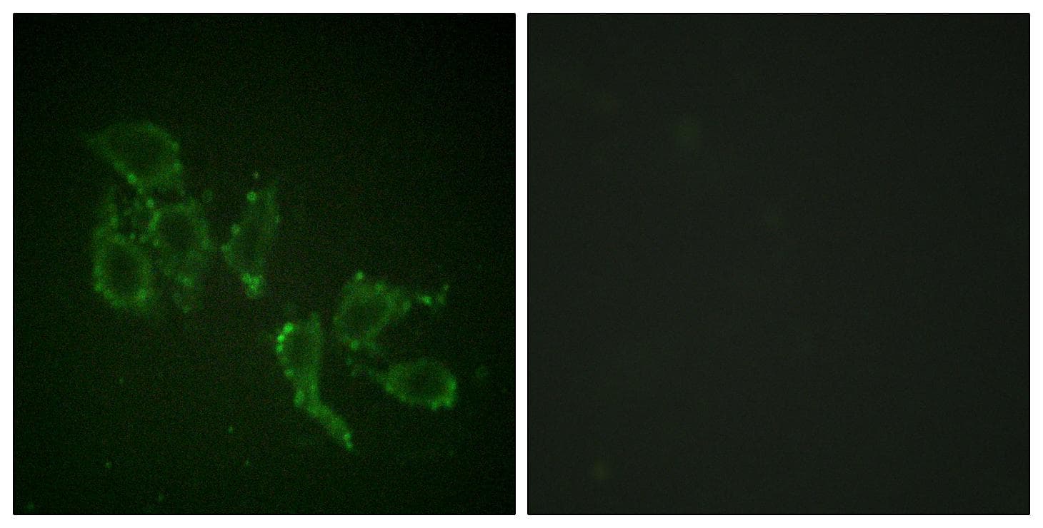 ARAF / ARAF1 / A-RAF Antibody (phospho-Tyr302)