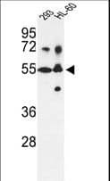Polyclonal Rabbit anti-Human CYP21A2 Antibody (aa59-87, WB)