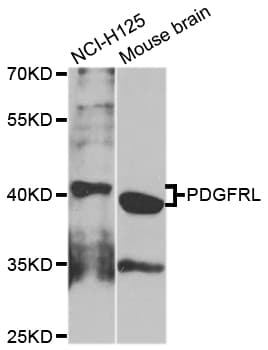 PRLTS / PDGFRL Antibody