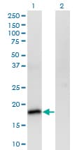 POU5F1 / OCT4 Antibody (clone 1D2)