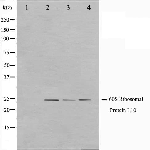 Polyclonal Rabbit anti-Human RPL10 / Ribosomal Protein L10 Antibody (IF, WB)