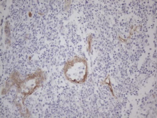 Monoclonal Mouse anti-Human SIP1 Antibody (clone OTI4C11, IHC, WB)