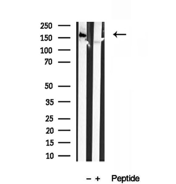 Polyclonal Rabbit anti-Human CAMSAP2 Antibody (IHC, IF, WB)
