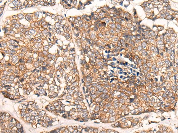 Polyclonal Rabbit anti-Human CACNA2D2 Antibody (IHC)