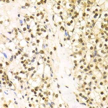 BAG1 / BAG-1 Antibody