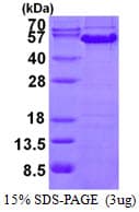 Human CCNA2 / Cyclin A2 Protein (Recombinant His)