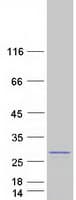 Human SPCS2 Protein (Recombinant Myc-DDK (Flag))