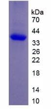 Rat Neuropeptide Y / NPY Protein (Recombinant His-GST)