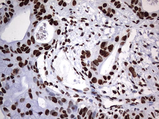 HNRPM / HNRNPM Antibody (aa1-261, clone OTI6H7)