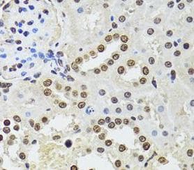 CDX2 Antibody
