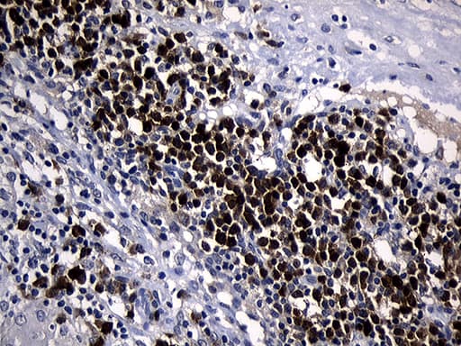 ZFP37 Antibody (clone OTI3H4)