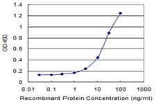 PPP2R5D Antibody (clone 1A3)