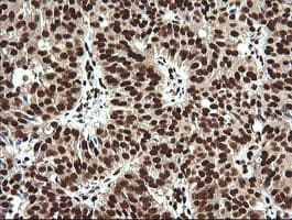 Monoclonal Mouse anti-Human SAE1 Antibody (clone 1G8, Carrier-free, IHC, IF, WB)