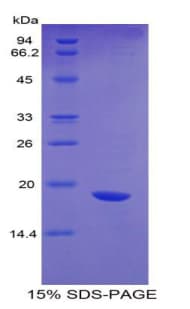 Chicken IL17 Protein (Recombinant His-GST, N-terminus)