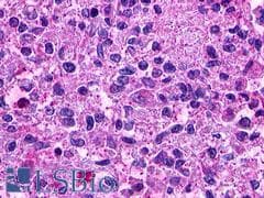 PathPlus™ Polyclonal Rabbit anti-Human GPR49 / LGR5 Antibody (Cytoplasmic Domain, IHC, IF)