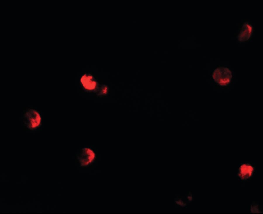 PathPlus™ CDKN1C / p57 Kip2 Antibody