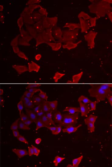 Polyclonal Rabbit anti-Human FLCN / Folliculin Antibody (IHC, IF, WB)