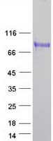 Human CD66a / CEACAM1 Protein (Recombinant Myc-DDK (Flag))