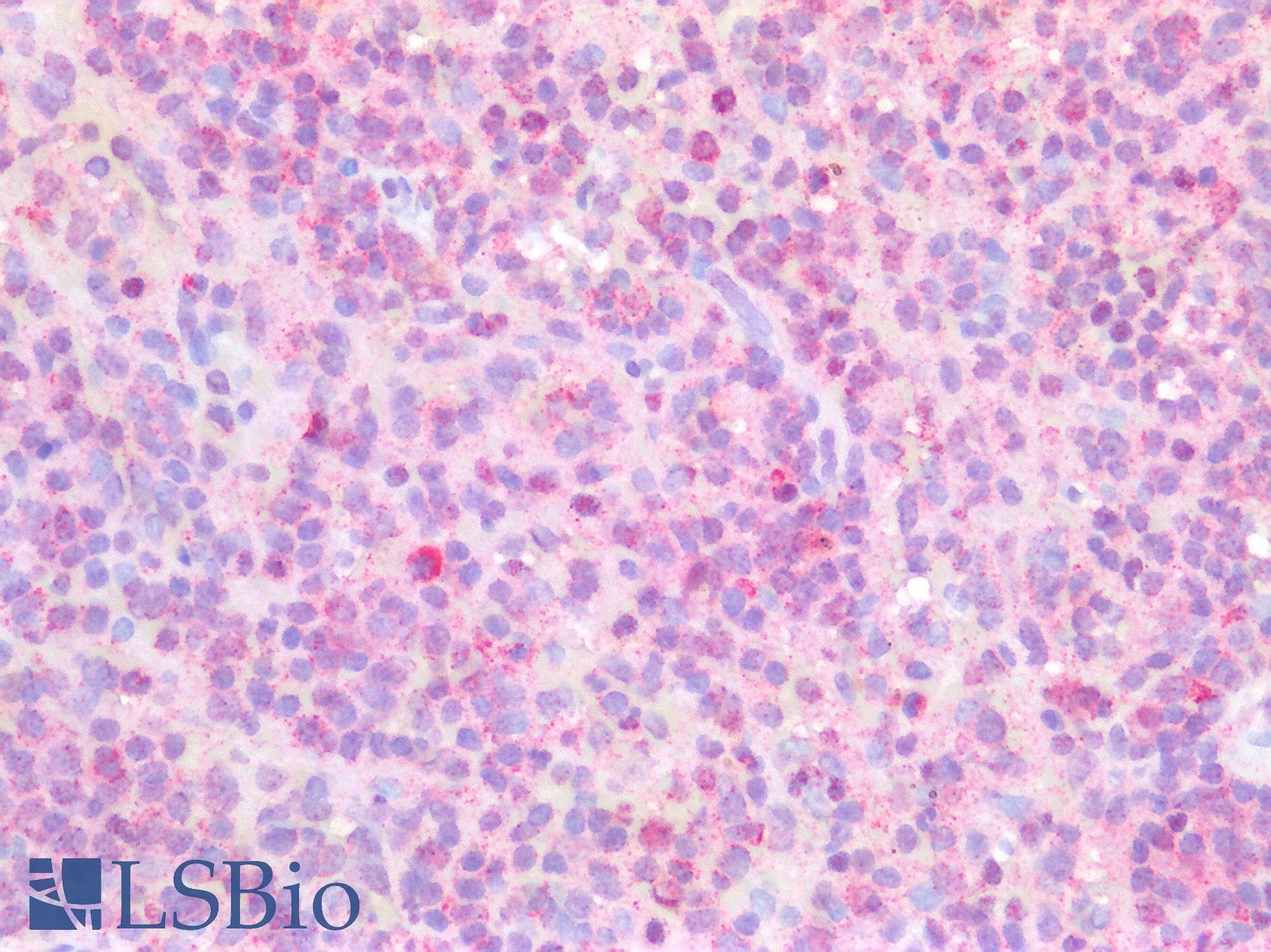 IHC-plus™ Osteonectin / SPARC Antibody