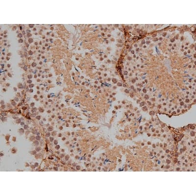 MAPT / Tau Antibody (phospho-Thr231)