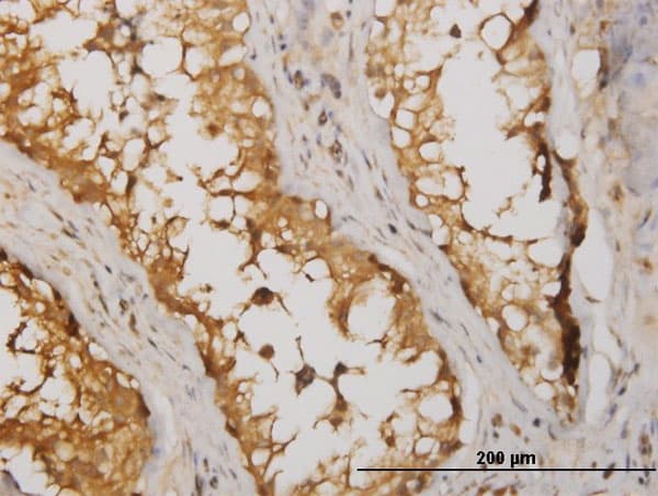 NME2 Antibody (clone 1D3)