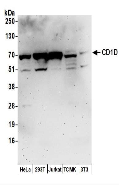 CD1D Antibody (aa75-125)