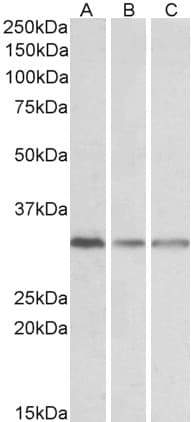 IHC-plus™ GNB2L1 / RACK1 Antibody (aa133-147)