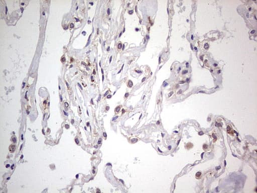 LGALS3 / Galectin 3 Antibody (clone OTI2F1)