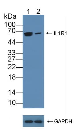 IL1R1 Antibody (aa21-109)