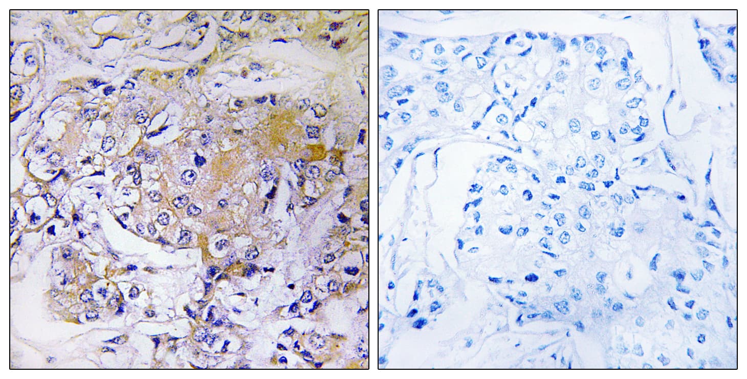 ULK3 Antibody (aa141-190)