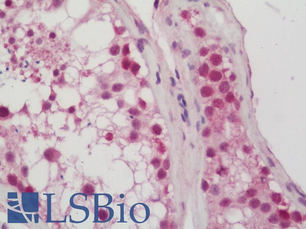 IHC-plus™ CDKN2AIPNL Antibody