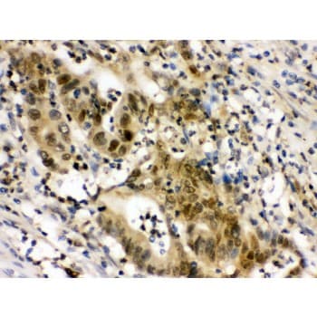 Polyclonal Rabbit anti-Human EIF6 Antibody (aa66-210, IHC, WB)