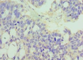 IHC-plus™ MER / MERTK Antibody (aa840-999)