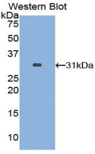 CA2 / Carbonic Anhydrase II Antibody (aa1-260)