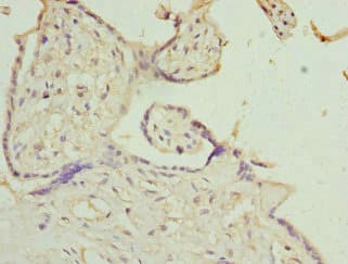 Polyclonal Rabbit anti-Human IL9R / CD129 Antibody (IHC)