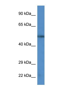 Polyclonal Rabbit anti-Human CAMK4 / CaMK IV Antibody (aa322-371, WB)