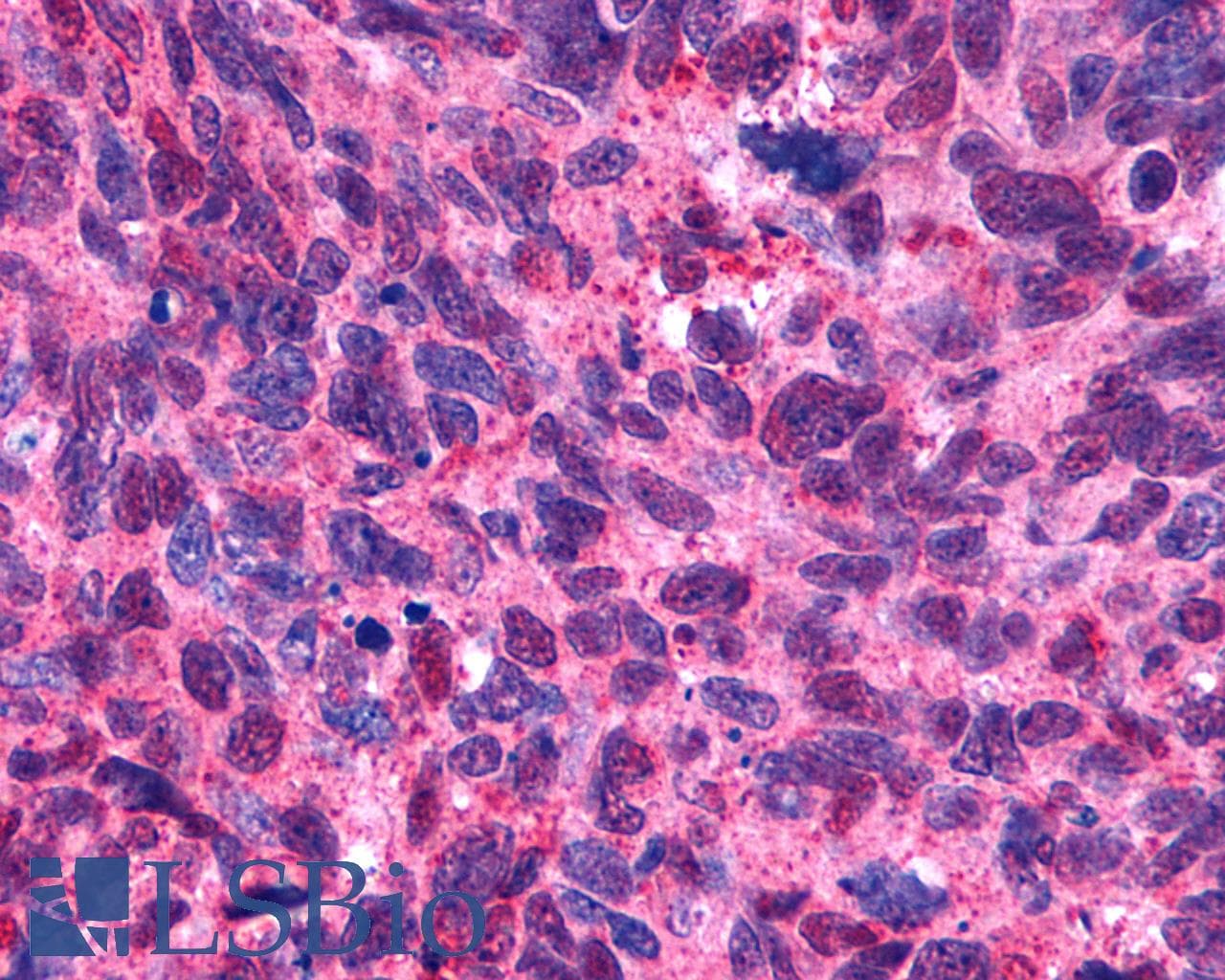 PathPlus™ HTR2B / 5-HT2B Receptor Antibody (Extracellular Domain)