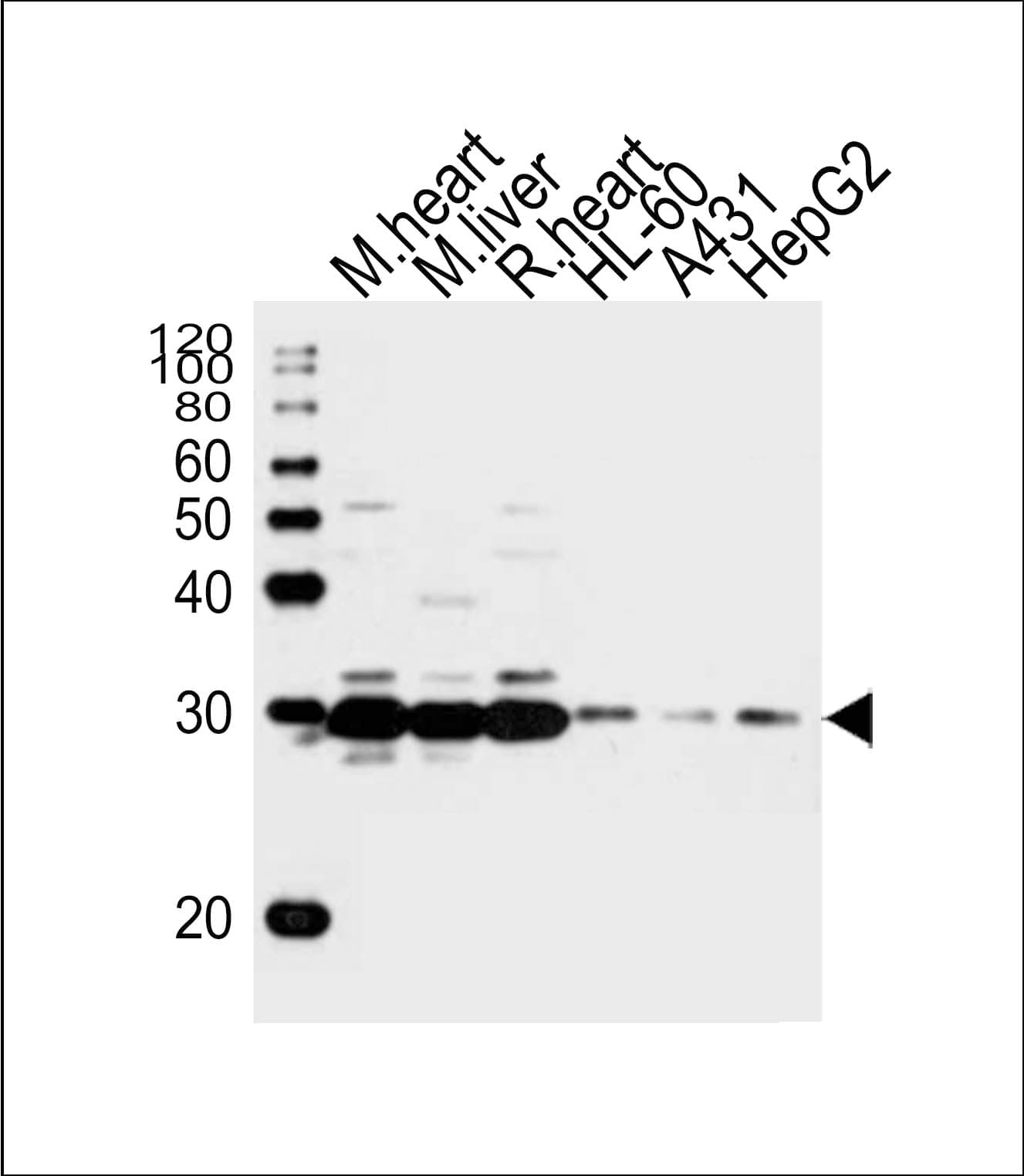 Polyclonal Rabbit anti-Zebrafish SDHB Antibody (aa147-182, WB)
