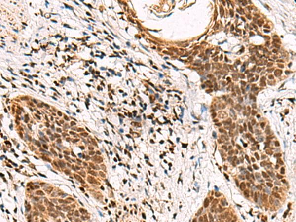 Polyclonal Rabbit anti-Human GABPB1 Antibody (IHC, WB)