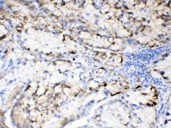 HBV / Hepatitis B Virus Antibody