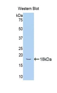 HPX / Hemopexin Antibody (aa324-462, PE)
