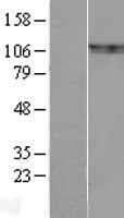 BCAR1 / p130Cas Protein (Over-Expression Lysate Myc-DDK (Flag))
