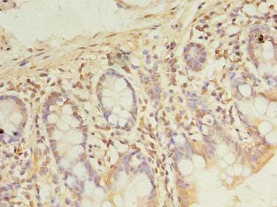 PDE6D / PDE6 Delta Antibody