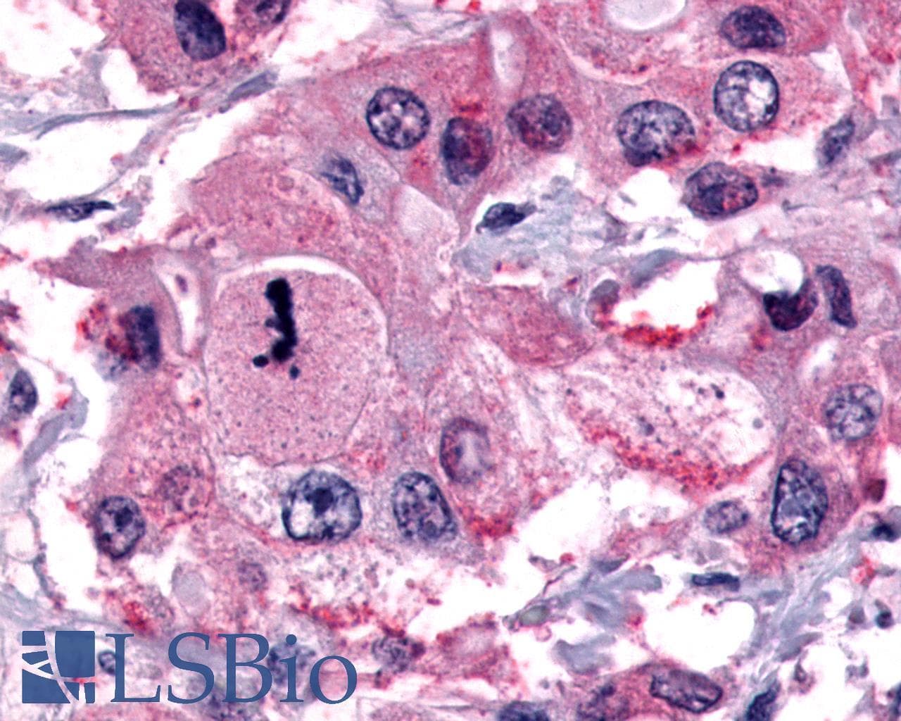 PathPlus™ TACR2 / NK2R Antibody (C-Terminus)