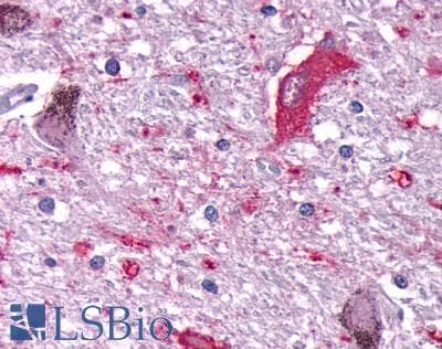 PathPlus™ Polyclonal Rabbit anti-Human DUSP26 / MKP8 Antibody (Internal, IHC)