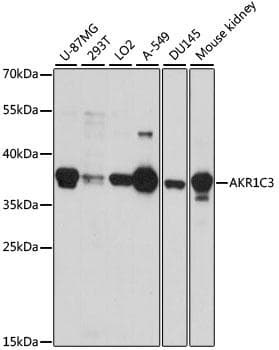 DDX / AKR1C3 Antibody
