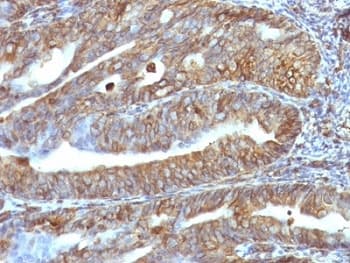 Vimentin Antibody (clone VM1170)